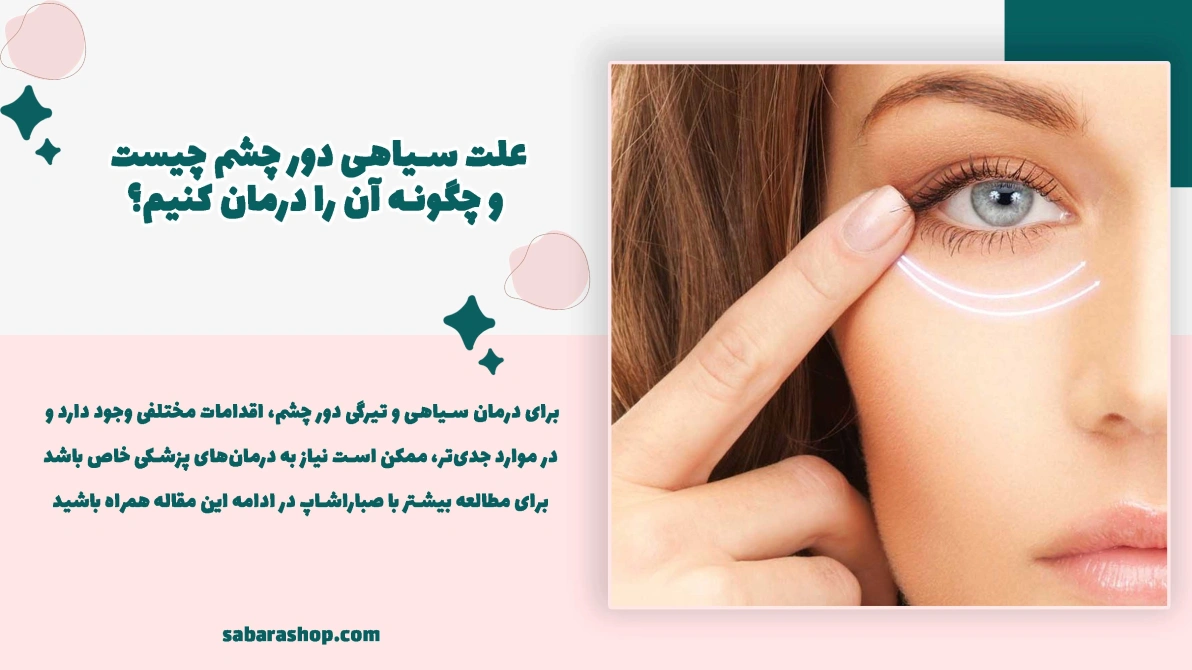 علت سیاهی دور چشم چیست و چگونه آن را درمان کنیم